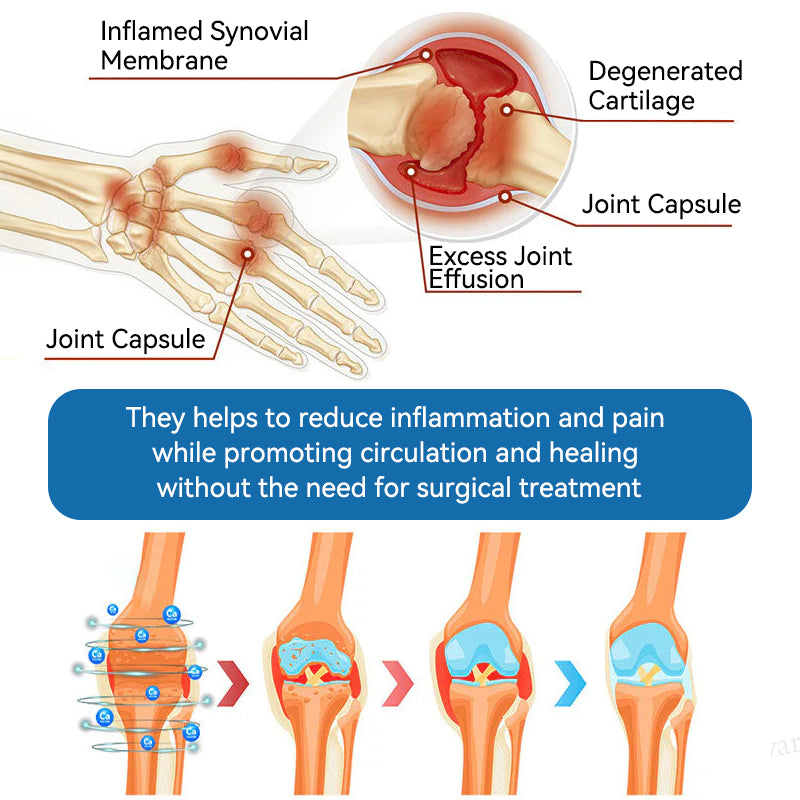 Love in Double! Buy One, Get One Free⏰﻿𝐟𝐥𝐲𝐬𝐦𝐮𝐬® 𝐁𝐏𝐂-𝟏𝟓𝟕 𝐉𝐨𝐢𝐧𝐭 𝐇𝐞𝐚𝐥𝐢𝐧𝐠 𝐂𝐫𝐞𝐚𝐦🦴Treats Arthritis, Neuropathy, Rheumatism, Sports Injuries & More🏆