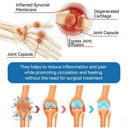 Love in Double! Buy One, Get One Free⏰﻿𝐟𝐥𝐲𝐬𝐦𝐮𝐬® 𝐁𝐏𝐂-𝟏𝟓𝟕 𝐉𝐨𝐢𝐧𝐭 𝐇𝐞𝐚𝐥𝐢𝐧𝐠 𝐂𝐫𝐞𝐚𝐦🦴Treats Arthritis, Neuropathy, Rheumatism, Sports Injuries & More🏆