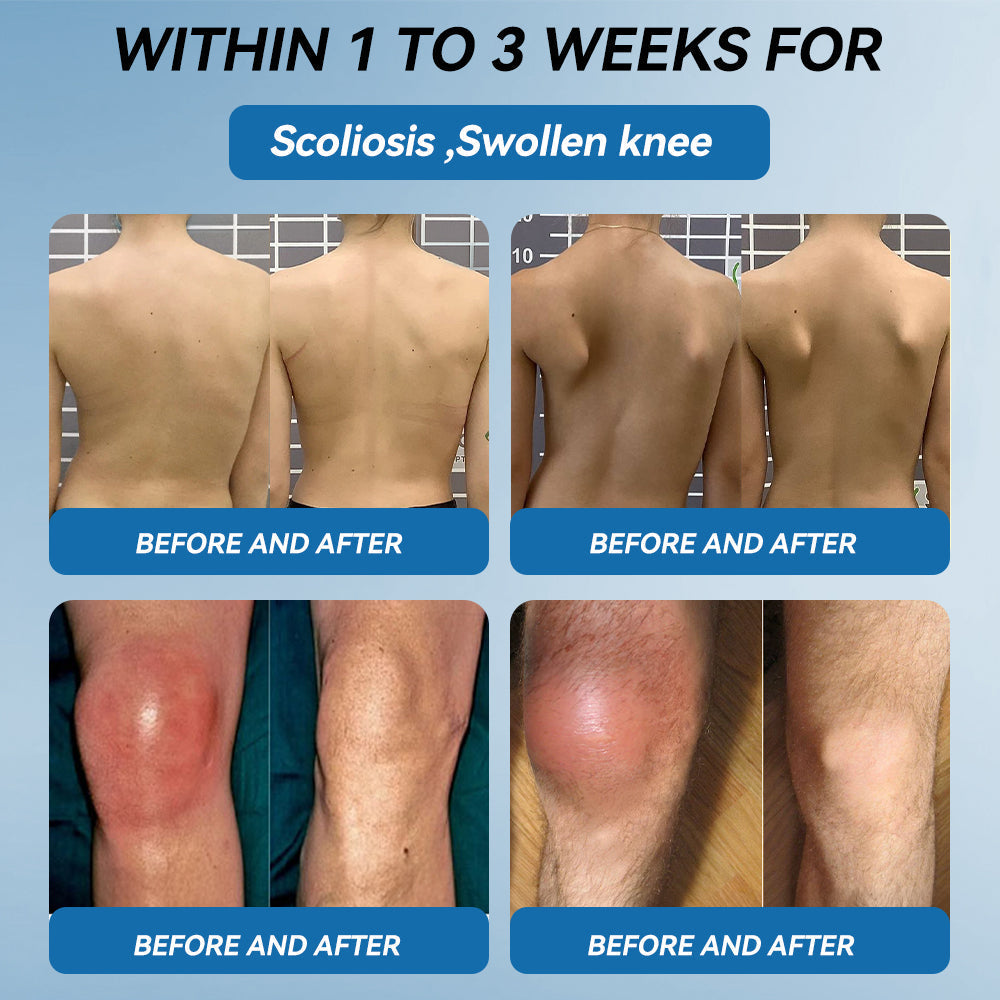 Love in Double! Buy One, Get One Free⏰﻿𝐟𝐥𝐲𝐬𝐦𝐮𝐬® 𝐁𝐏𝐂-𝟏𝟓𝟕 𝐉𝐨𝐢𝐧𝐭 𝐇𝐞𝐚𝐥𝐢𝐧𝐠 𝐂𝐫𝐞𝐚𝐦🦴Treats Arthritis, Neuropathy, Rheumatism, Sports Injuries & More🏆