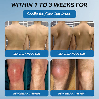 Love in Double! Buy One, Get One Free⏰﻿𝐟𝐥𝐲𝐬𝐦𝐮𝐬® 𝐁𝐏𝐂-𝟏𝟓𝟕 𝐉𝐨𝐢𝐧𝐭 𝐇𝐞𝐚𝐥𝐢𝐧𝐠 𝐂𝐫𝐞𝐚𝐦🦴Treats Arthritis, Neuropathy, Rheumatism, Sports Injuries & More🏆