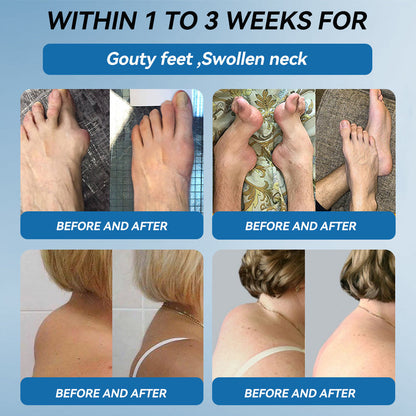 Love in Double! Buy One, Get One Free⏰﻿𝐟𝐥𝐲𝐬𝐦𝐮𝐬® 𝐁𝐏𝐂-𝟏𝟓𝟕 𝐉𝐨𝐢𝐧𝐭 𝐇𝐞𝐚𝐥𝐢𝐧𝐠 𝐂𝐫𝐞𝐚𝐦🦴Treats Arthritis, Neuropathy, Rheumatism, Sports Injuries & More🏆