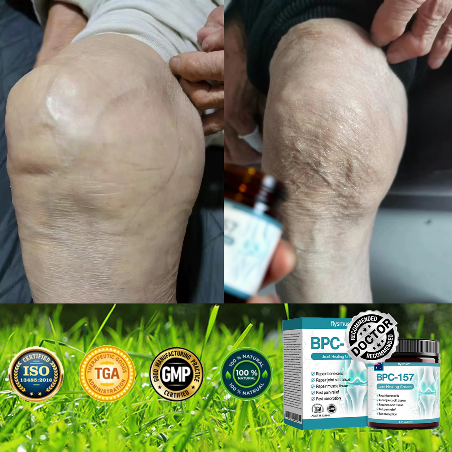 Love in Double! Buy One, Get One Free⏰﻿𝐟𝐥𝐲𝐬𝐦𝐮𝐬® 𝐁𝐏𝐂-𝟏𝟓𝟕 𝐉𝐨𝐢𝐧𝐭 𝐇𝐞𝐚𝐥𝐢𝐧𝐠 𝐂𝐫𝐞𝐚𝐦🦴Treats Arthritis, Neuropathy, Rheumatism, Sports Injuries & More🏆